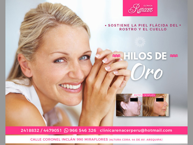 Rejuvenecimiento facial con hilos - Clínica Renacer