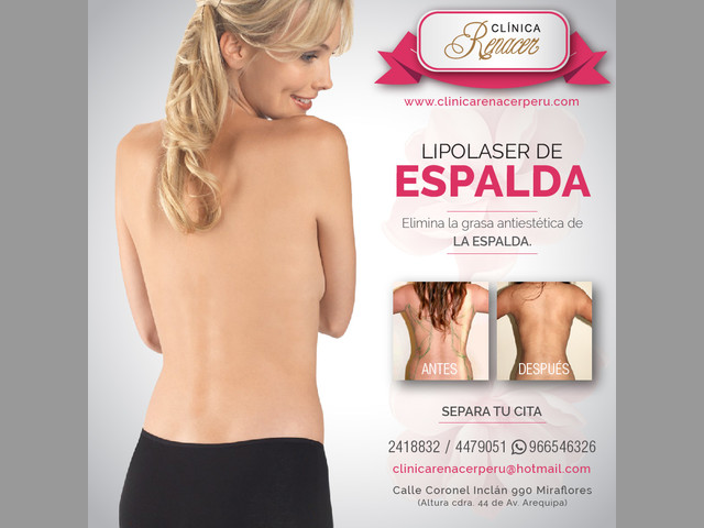 Mejora la definición de la espalda - Clínica Renacer