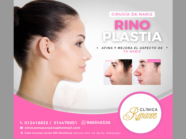Mejora el aspecto de tu nariz - Clínica Renacer