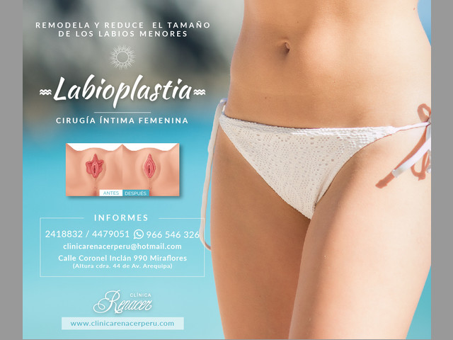Reduce los labios menores - Clínica Renacer