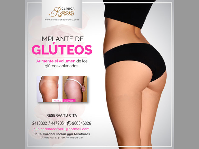 Mejora el volumen de tus glúteos - Clínica Renacer