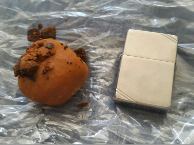 Compramos cálculos biliares (Gallstone)