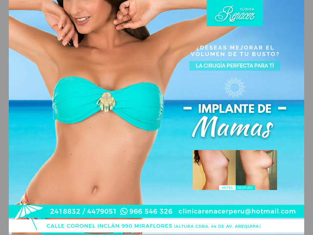 Implante mamario - Clínica Renacer