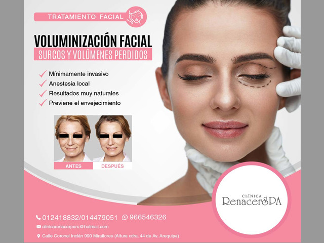 VOLUMINIZACIÓN FACIAL-Clínica Renacer SPA