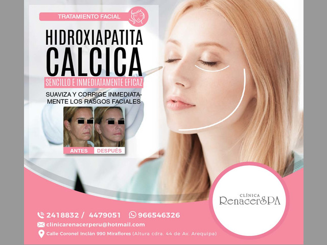 Hidroxiapatita cálcica