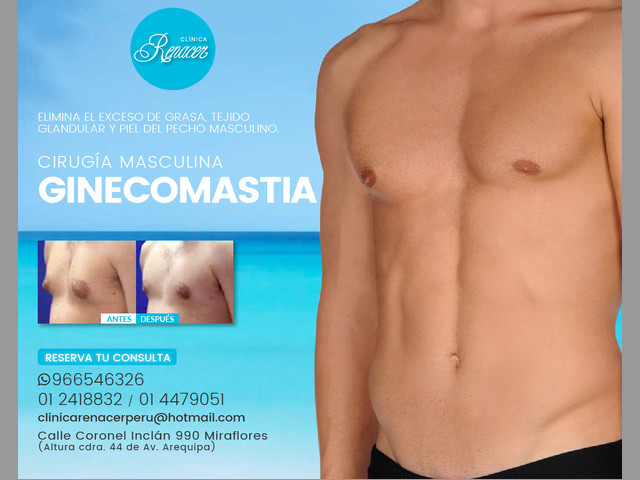 Disminuye la Ginecomastia - Clínica Renacer